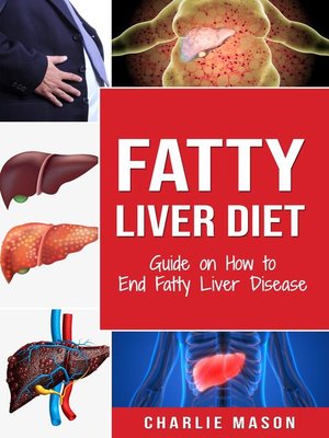 cover image of Fatty Liver Diet Guide on How to End Fatty Liver Disease Fatty Liver Diet Books